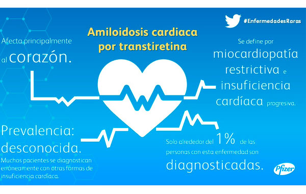 Infografía sobre la amiloidosis cardiaca por transtiretina.